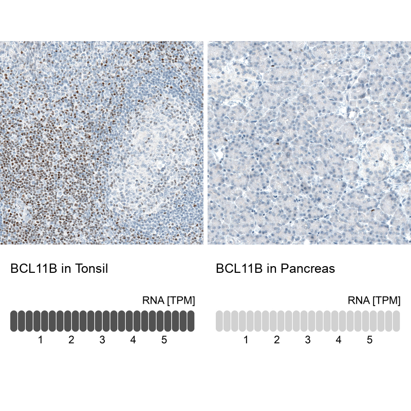 Atlas Antibodies Anti-BCL11B Antibody