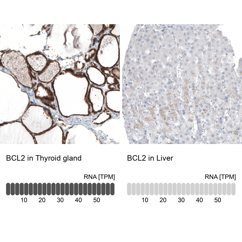 Atlas Antibodies Anti-BCL2 Antibody