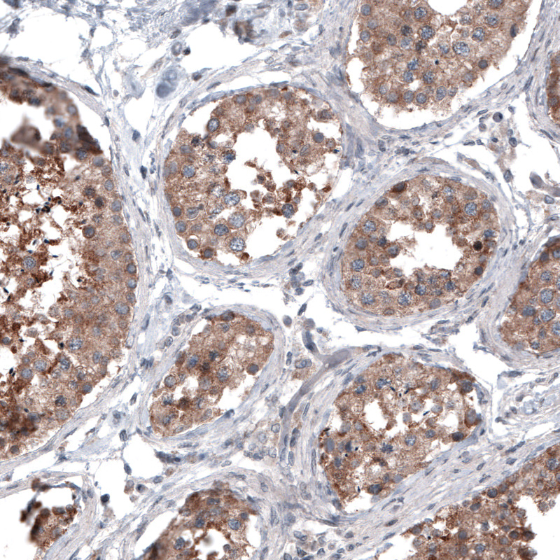 Atlas Antibodies Anti-BRAF Antibody