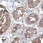 Atlas Antibodies Anti-BRAF Antibody