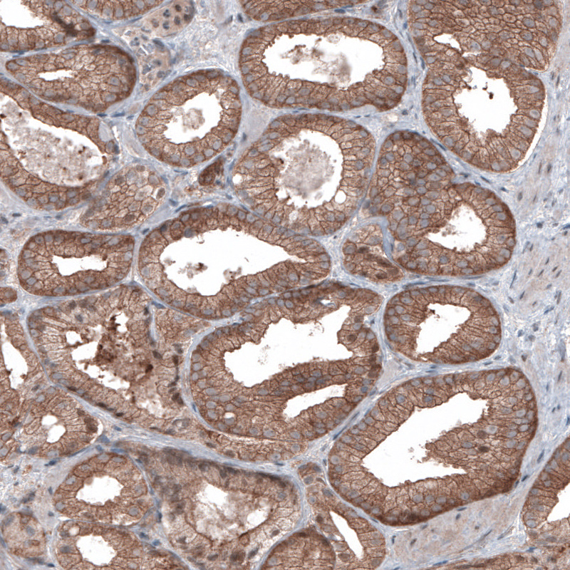Atlas Antibodies Anti-BRAF Antibody