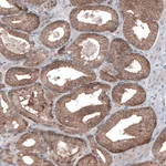 Atlas Antibodies Anti-BRAF Antibody