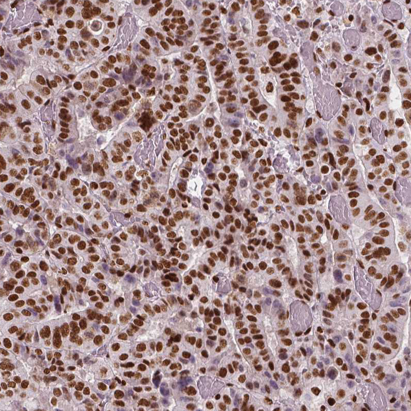 Atlas Antibodies Anti-BRD4 Antibody