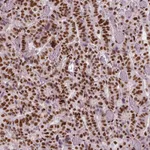 Atlas Antibodies Anti-BRD4 Antibody