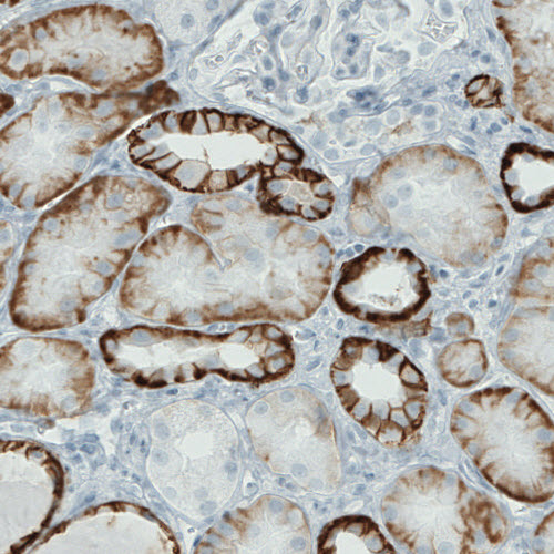 Atlas Antibodies Anti-CA12 Antibody