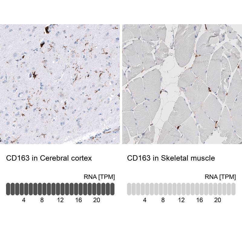 Atlas Antibodies Anti-CD163 Antibody