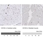 Atlas Antibodies Anti-CD163 Antibody