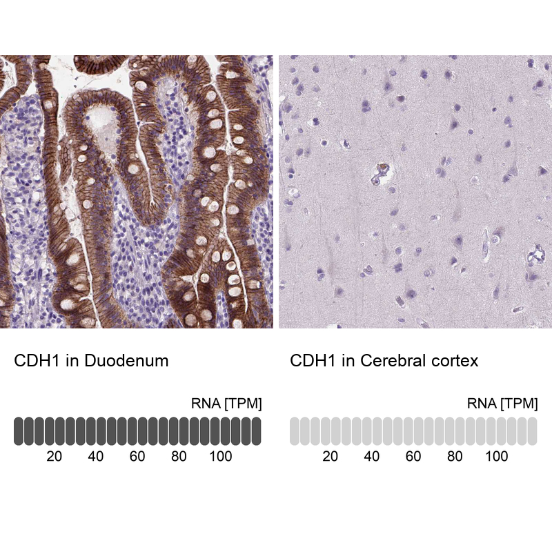 Atlas Antibodies Anti-CDH1 Antibody