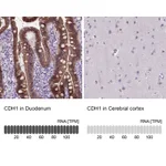 Atlas Antibodies Anti-CDH1 Antibody