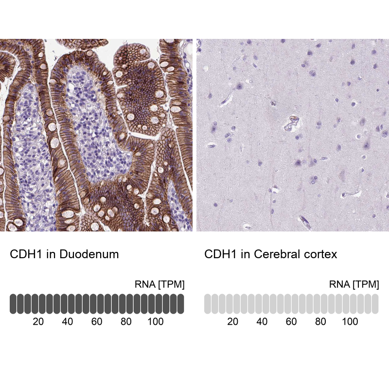 Atlas Antibodies Anti-CDH1 Antibody