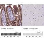 Atlas Antibodies Anti-CDH1 Antibody