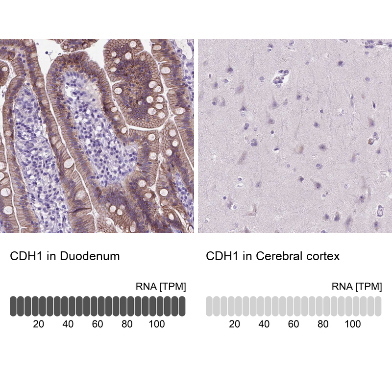 Atlas Antibodies Anti-CDH1 Antibody