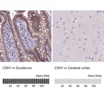 Atlas Antibodies Anti-CDH1 Antibody