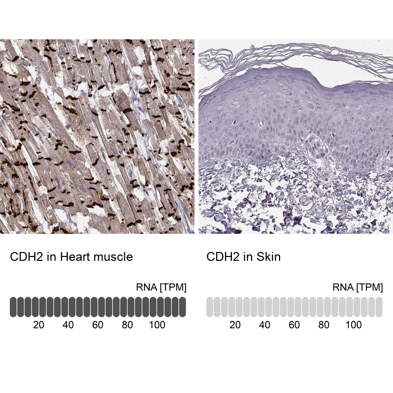 Atlas Antibodies Anti-CDH2 Antibody