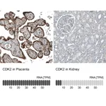 Atlas Antibodies Anti-CDK2 Antibody