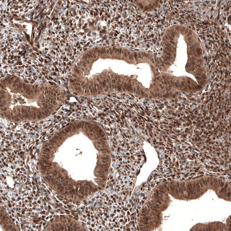 Atlas Antibodies Anti-CDK4 Antibody