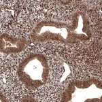 Atlas Antibodies Anti-CDK4 Antibody