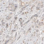 Atlas Antibodies Anti-CDK5RAP2 Antibody