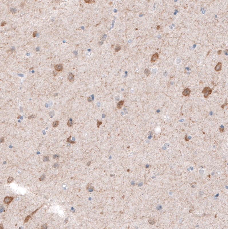 Atlas Antibodies Anti-CDKL5 Antibody