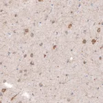 Atlas Antibodies Anti-CDKL5 Antibody