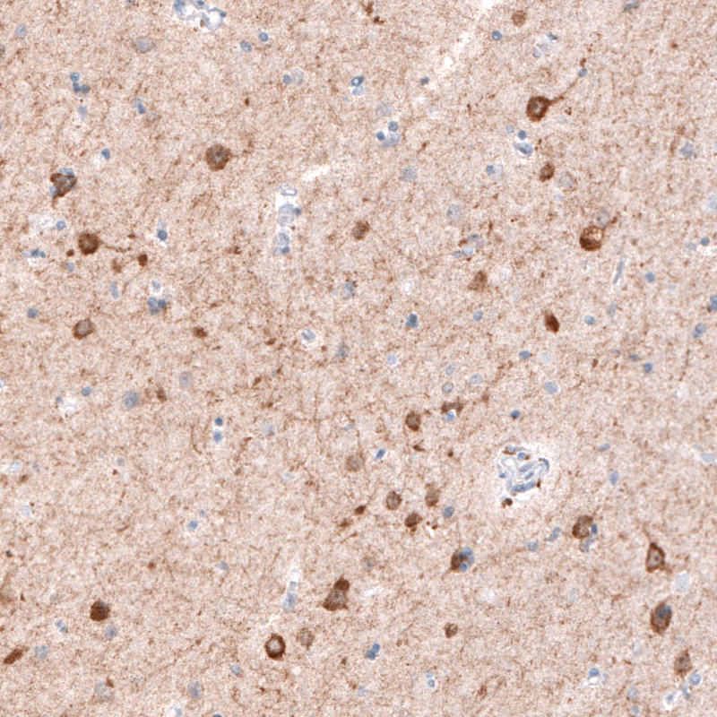 Atlas Antibodies Anti-CDKL5 Antibody