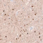 Atlas Antibodies Anti-CDKL5 Antibody