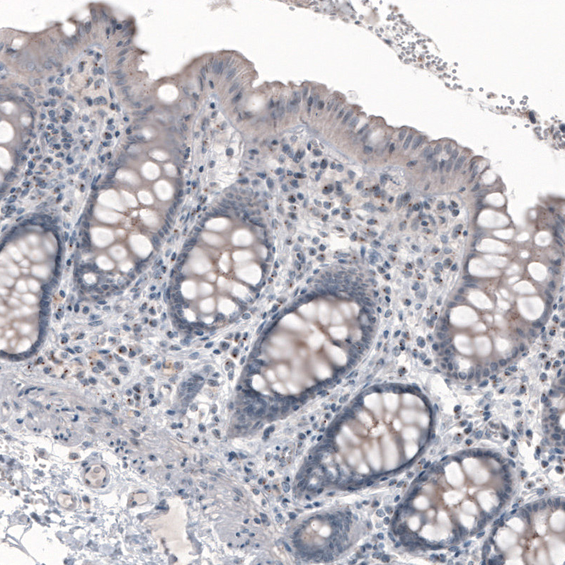 Atlas Antibodies Anti-CEP350 Antibody