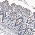 Atlas Antibodies Anti-CEP350 Antibody