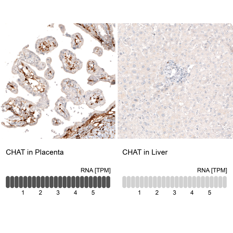 Atlas Antibodies Anti-CHAT Antibody
