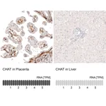 Atlas Antibodies Anti-CHAT Antibody