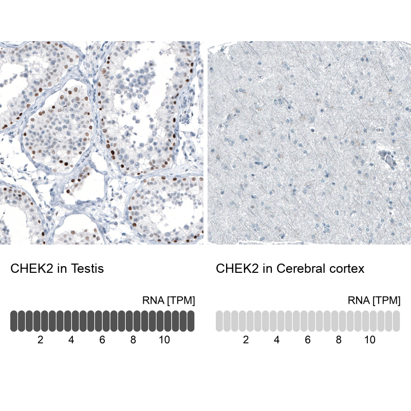 Atlas Antibodies Anti-CHEK2 Antibody