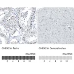 Atlas Antibodies Anti-CHEK2 Antibody