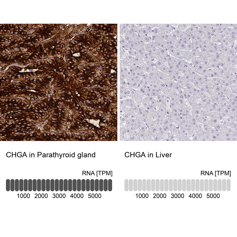 Atlas Antibodies Anti-CHGA Antibody