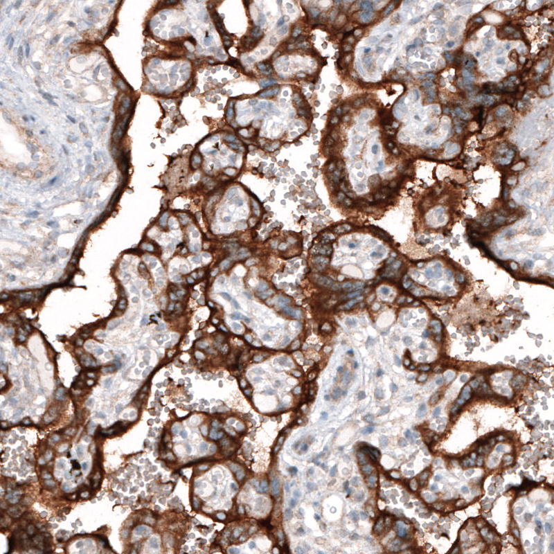 Atlas Antibodies Anti-CLIP1 Antibody