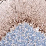 Atlas Antibodies Anti-CLIP1 Antibody