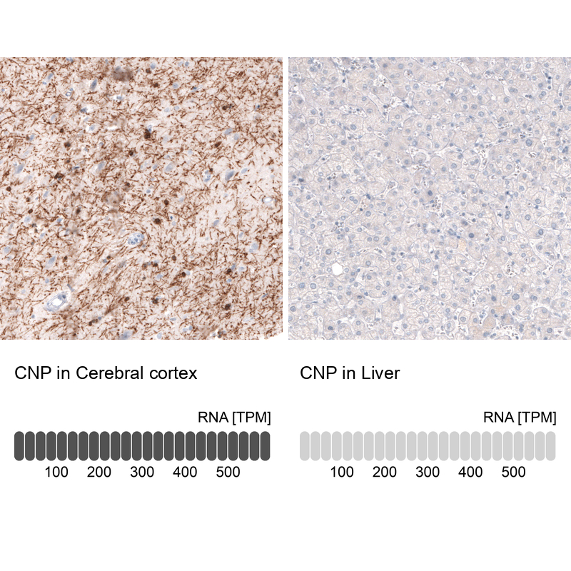 Atlas Antibodies Anti-CNP Antibody
