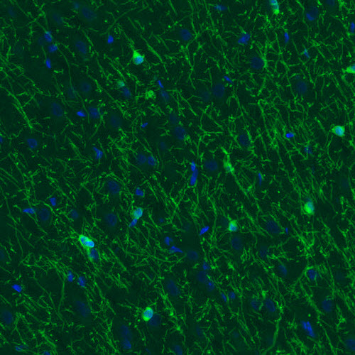 Atlas Antibodies Anti-CNP Antibody