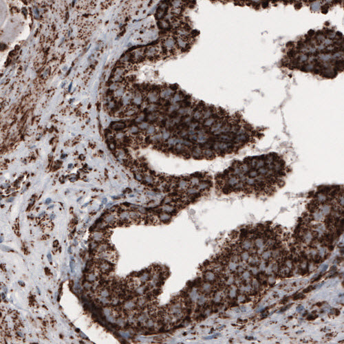 Atlas Antibodies Anti-COX4I1 Antibody