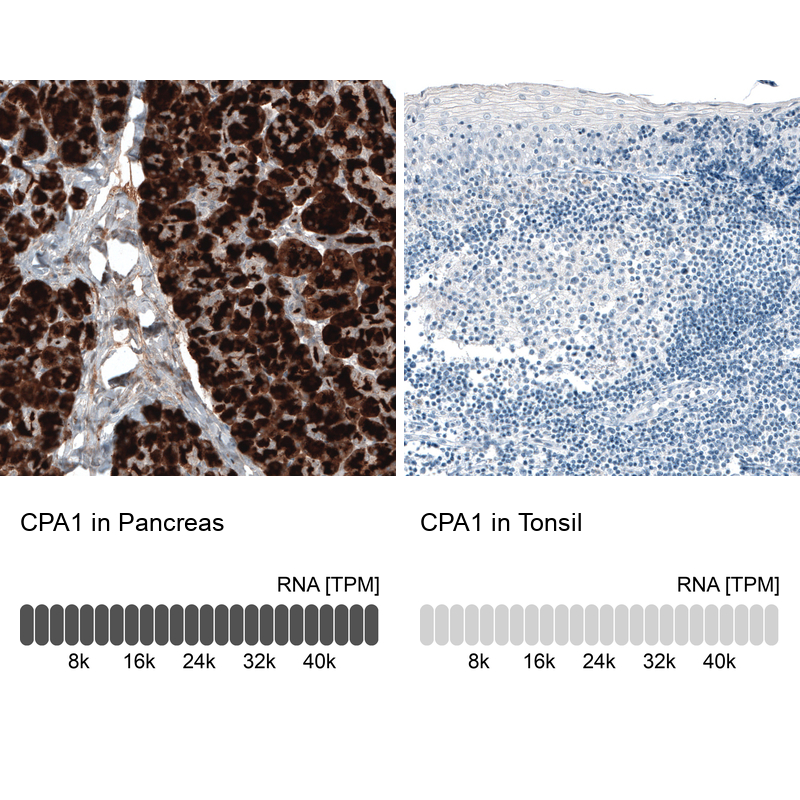 Atlas Antibodies Anti-CPA1 Antibody