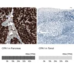 Atlas Antibodies Anti-CPA1 Antibody