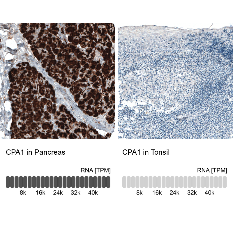 Atlas Antibodies Anti-CPA1 Antibody
