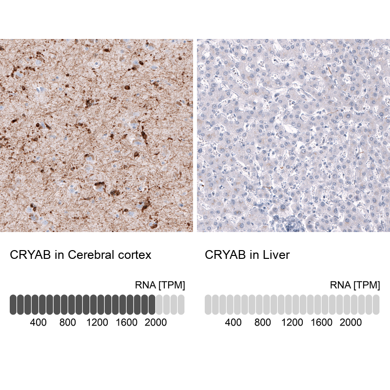 Atlas Antibodies Anti-CRYAB Antibody