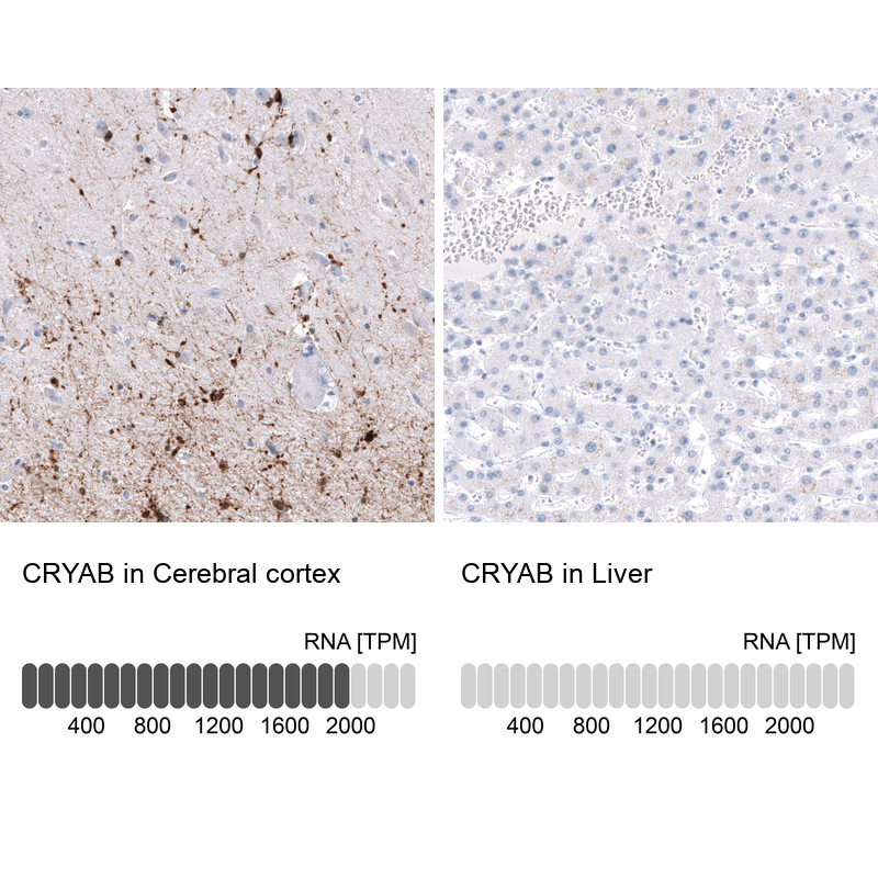 Atlas Antibodies Anti-CRYAB Antibody