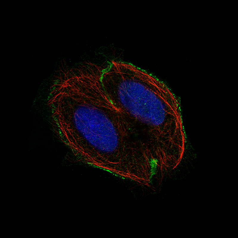 Atlas Antibodies Anti-CSF1R Antibody