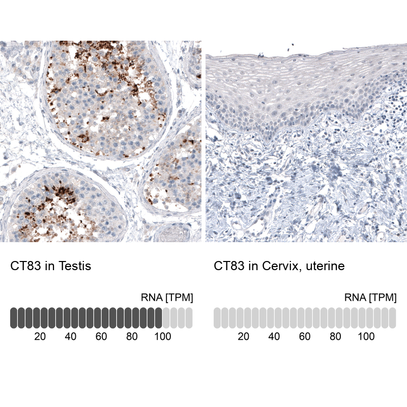 Atlas Antibodies Anti-CT83 Antibody