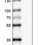 Atlas Antibodies Anti-CTAG1B Antibody