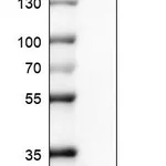 Atlas Antibodies Anti-CTAG1B Antibody