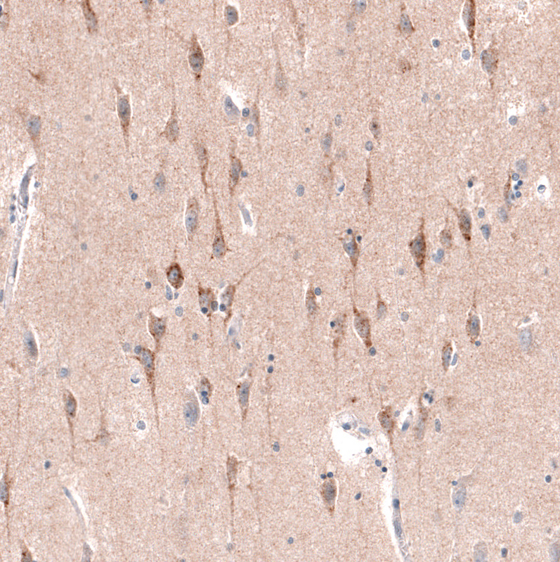 Atlas Antibodies Anti-CTGF Antibody