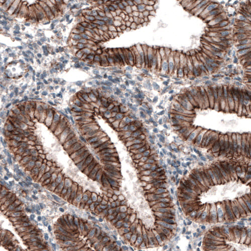 Atlas Antibodies Anti-CTNNB1 Antibody