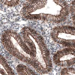 Atlas Antibodies Anti-CTNNB1 Antibody